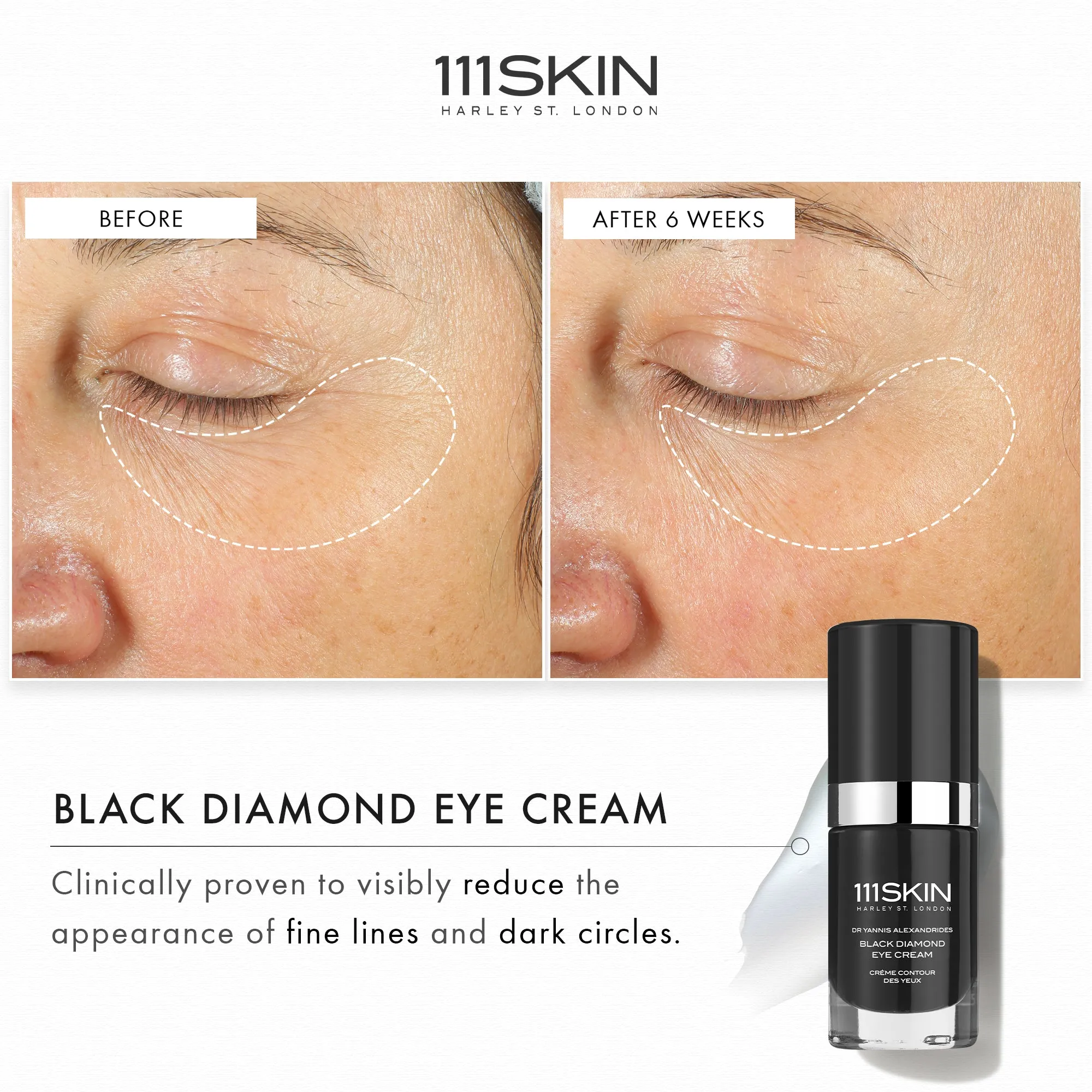 Black Diamond Eye Cream