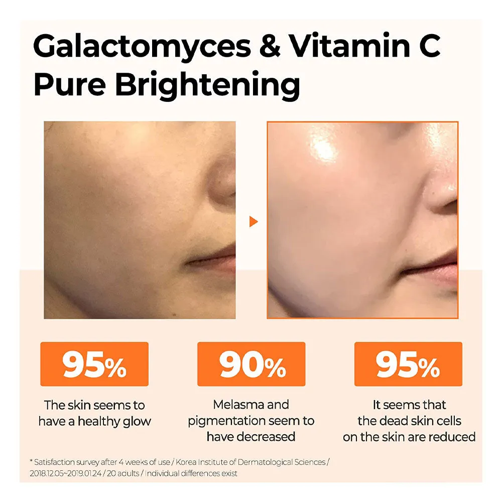 Galactomyces Pure Vitamin C Glow Serum