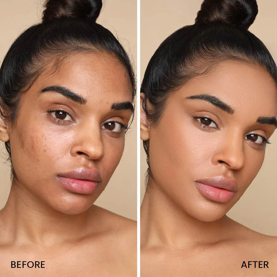 Matched & Snatched Kit