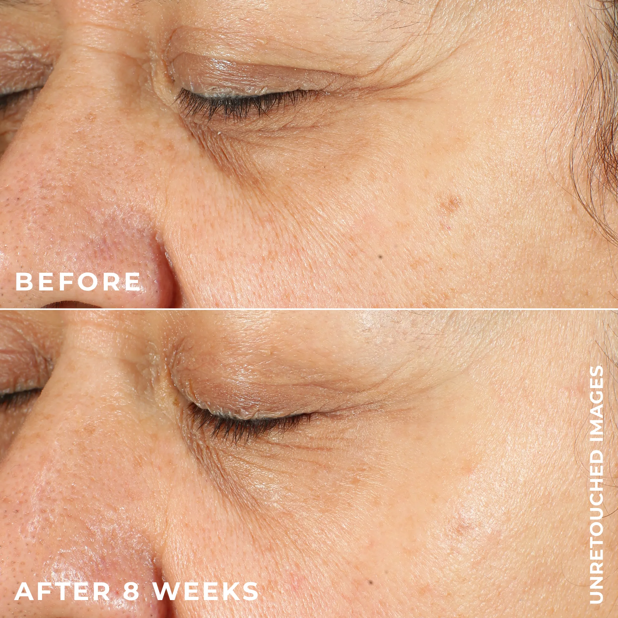 MULTI CORREXION® Revive   Glow Daily Serum