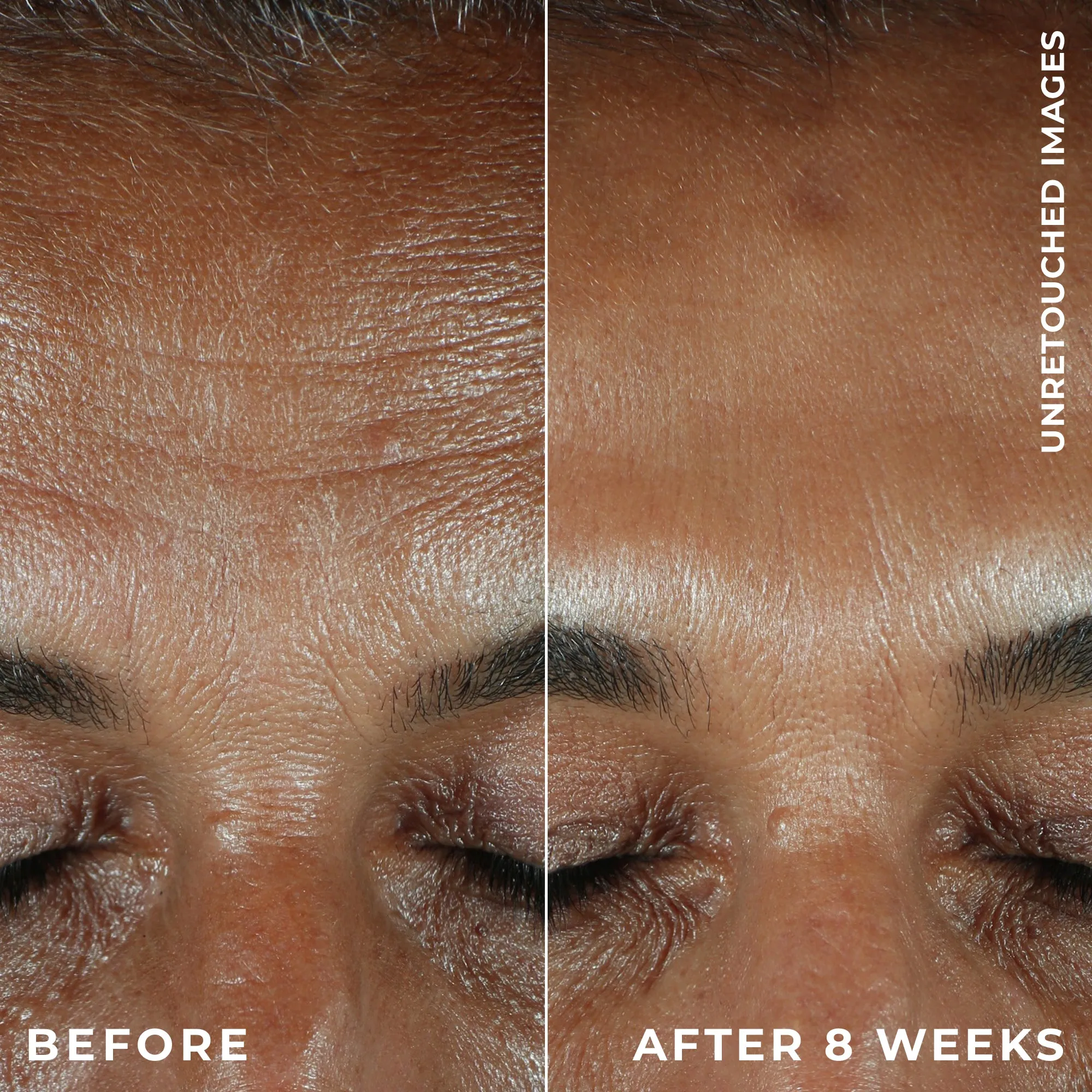 MULTI CORREXION® Revive   Glow Daily Serum
