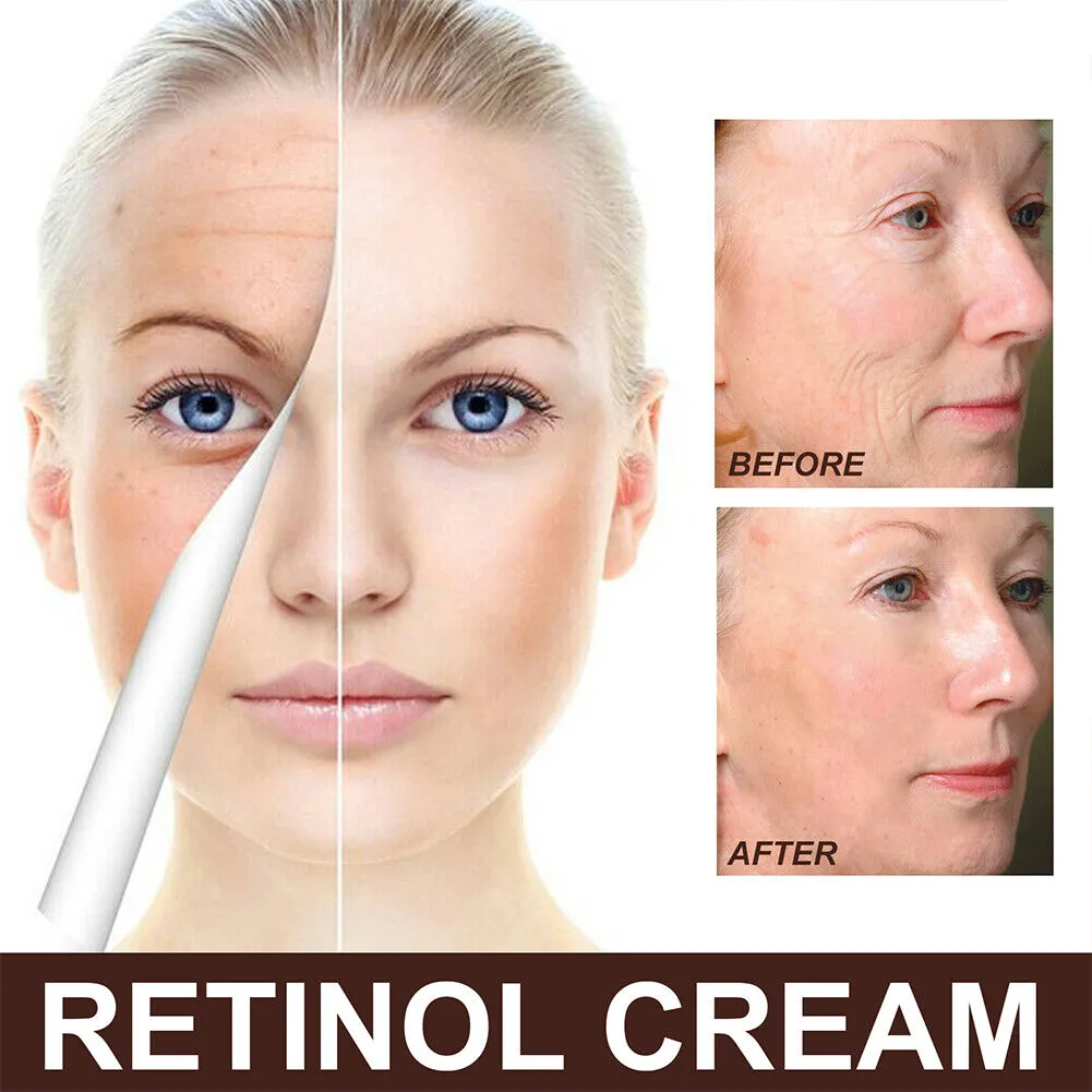 US 1-2 Pcs Anti-Wrinkle Face Retinol Cream Anti-Aging Moisturizer Firming Facial