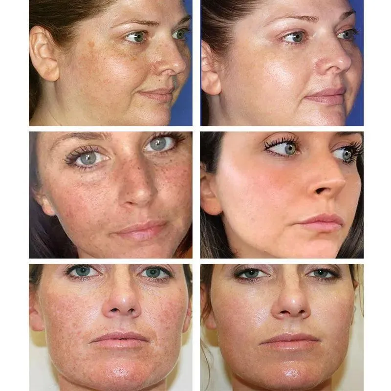 Vitamin C Brightening Cream: Dark Spot Remover & Anti-Aging Solution